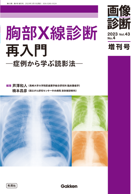画像診断 2023年増刊号（Vol.43 No.4） 胸部X線診断再入門 ─症例から学ぶ読影法─