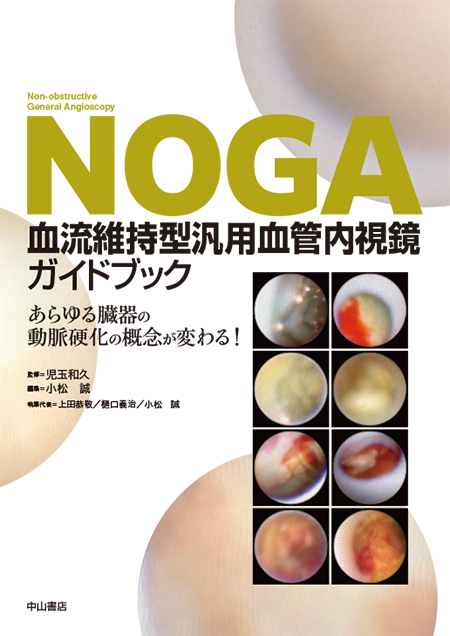 NOGA血流維持型汎用血管内視鏡ガイドブック　あらゆる臓器の動脈硬化の概念が変わる！