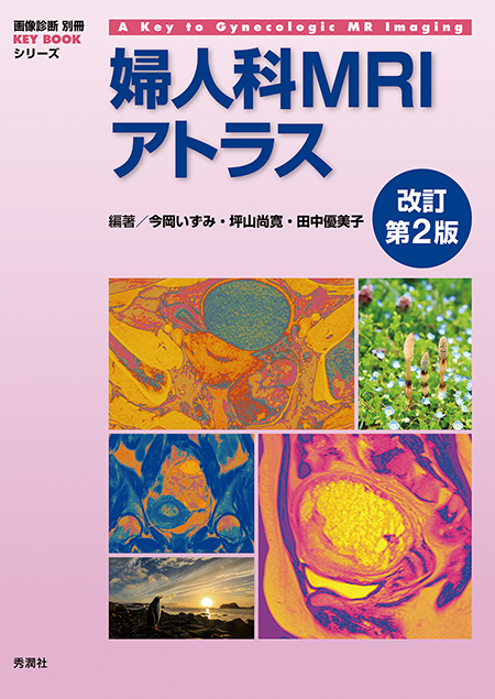 画像診断別冊 KEY BOOKシリーズ 婦人科MRIアトラス　改訂第2版