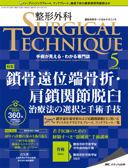整形外科 SURGICAL TECHNIQUE 2019年5号　特集:鎖骨遠位端骨折・肩鎖関節脱臼 治療法の選択と手術手技