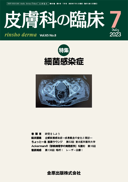 皮膚科の臨床 2023年7月号 65巻8号 特集 細菌感染症 【電子版】