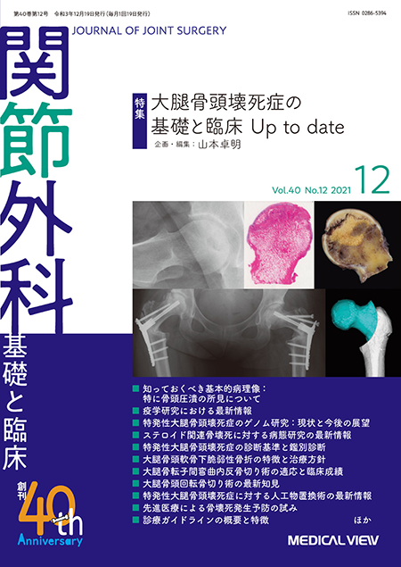関節外科 2021年12月号 Vol.40 No.12 大腿骨頭壊死症の基礎と臨床Up to date