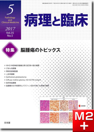 病理と臨床 2017年 5月号（35巻5号）脳腫瘍のトピックス