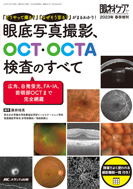 眼科ケア2023年春季増刊 眼底写真撮影、OCT・OCTA検査のすべて