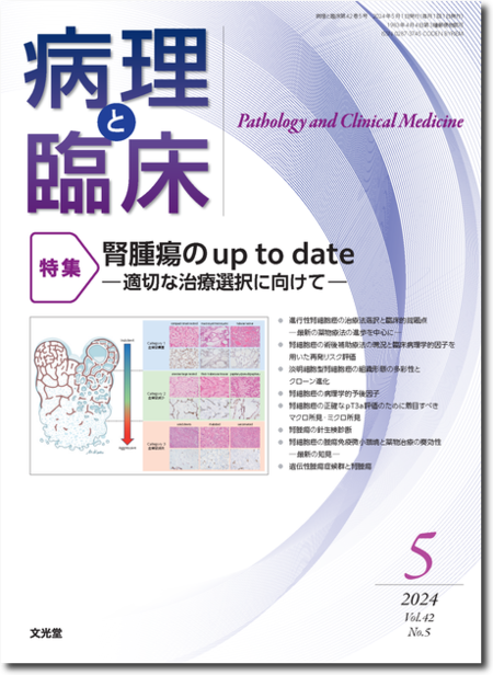 病理と臨床 2024年5月号（42巻5号）腎腫瘍のup to date―適切な治療選択に向けて―