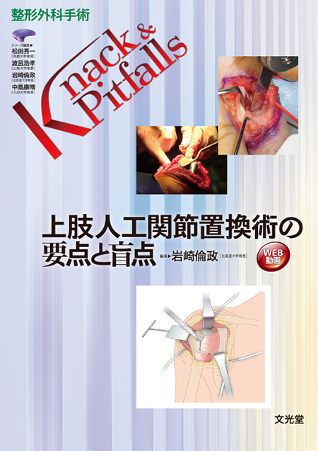 整形外科手術Knack & Pitfalls 上肢人工関節置換術の要点と盲点