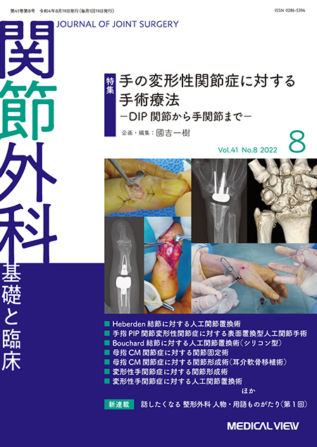 関節外科 2022年8月号 Vol.41 No.8 手の変形性関節症に対する手術療法－DIP関節から手関節まで－
