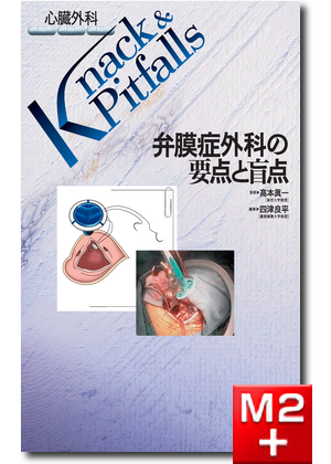 m3.com 電子書籍 | 整形外科 Knack & Pitfalls 肘関節外科の要点と盲点
