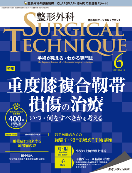 整形外科 SURGICAL TECHNIQUE 2022年6号　特集:重度膝複合靱帯損傷の治療