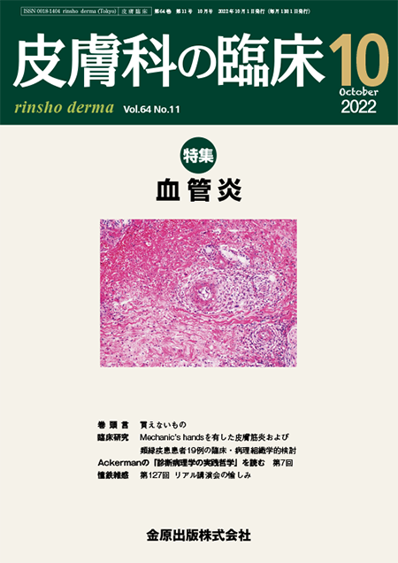 皮膚科の臨床 2022年10月号 64巻11号 特集 血管炎 【電子版】