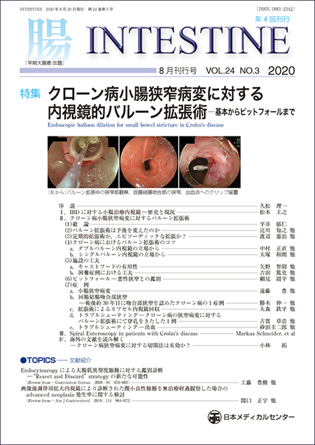 INTESTINE 2020 Vol.24 No.3 クローン病小腸狭窄病変に対する内視鏡的バルーン拡張術─基本からピットフォールまで