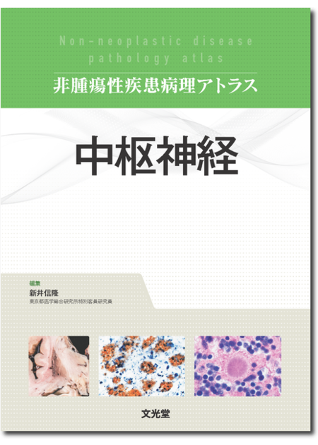 m3.com 電子書籍 | 非腫瘍性疾患病理アトラス 肺