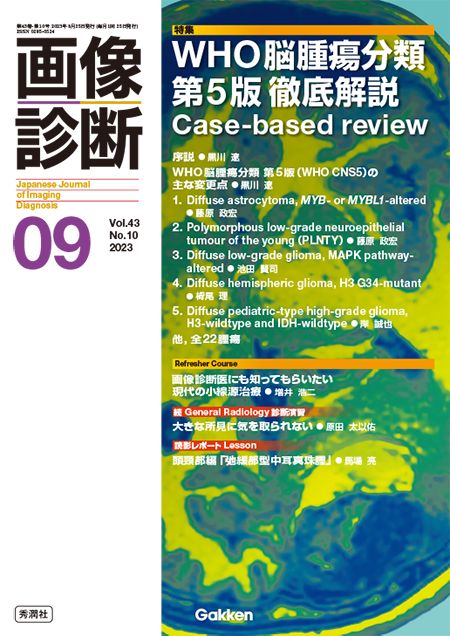 画像診断 2023年9月号（Vol.43 No.10）「WHO 脳腫瘍分類 第5版 徹底解説Case-based review」