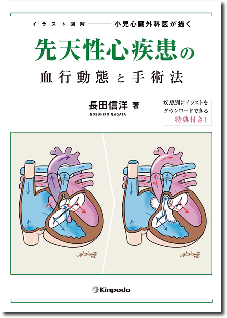 イラスト図解　小児心臓外科医が描く先天性心疾患の血行動態と手術法