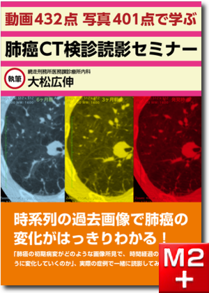 【動画432点 写真401点で学ぶ】肺癌CT検診読影セミナー