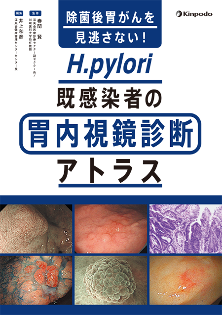 除菌後胃がんを見逃さない！　H.pylori既感染者の胃内視鏡診断アトラス
