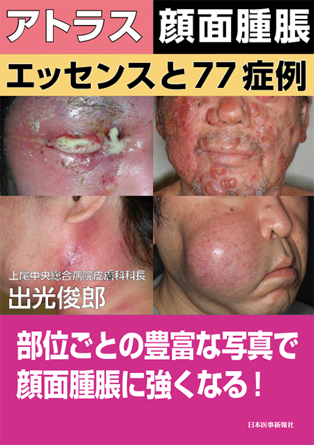 M2PLUS | 皮膚病理のすべて Ⅲ 腫瘍性皮膚疾患