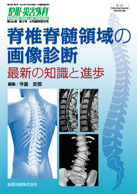 整形・災害外科 2023年4月臨時増刊号 66巻5号 特集 脊椎脊髄領域の画像診断―最新の知識と進歩― 【電子版】