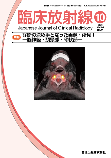 臨床放射線 2021年10月号 66巻11号 特集 診断の決め手となった画像・所見Ⅰ―脳神経・頭頸部・骨軟部― 【電子版】