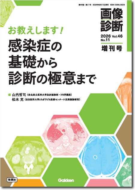 画像診断 2026年増刊号 Vol.46 No.11 お教えします! 感染症の基礎から診断の極意まで