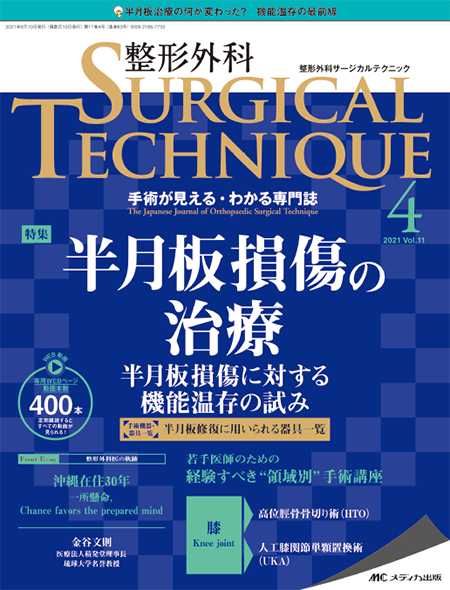 整形外科 SURGICAL TECHNIQUE 2021年4号　特集:半月板損傷の治療 半月板損傷に対する機能温存の試み