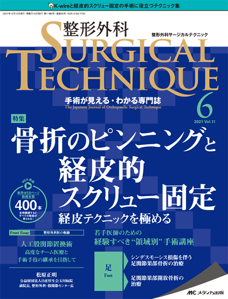 整形外科 SURGICAL TECHNIQUE 2021年6号　特集:骨折のピンニングと経皮的スクリュー固定 経皮テクニックを極める