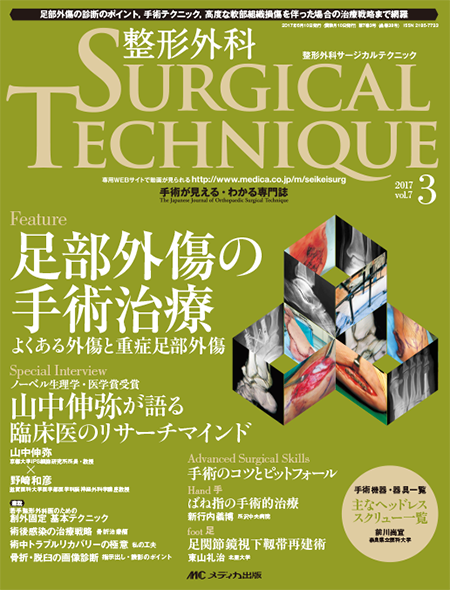 整形外科 SURGICAL TECHNIQUE 2017年3号　特集:足部外傷の手術治療 よくある外傷と重症足部外傷