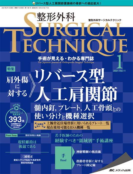 整形外科 SURGICAL TECHNIQUE 2021年1号　特集:肩外傷に対するリバース型人工肩関節 髄内釘,プレート,人工骨頭との使い分けと機種選択
