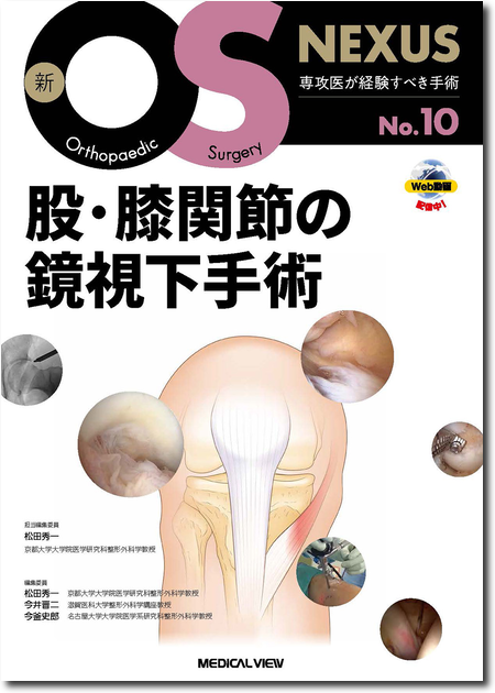 新OS NEXUS　No.10　股・膝関節の鏡視下手術［Web動画付］