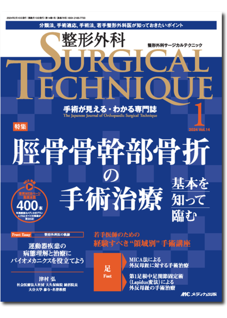 整形外科 SURGICAL TECHNIQUE 2024年1号　　特集:脛骨骨幹部骨折の手術治療　基本を知って臨む