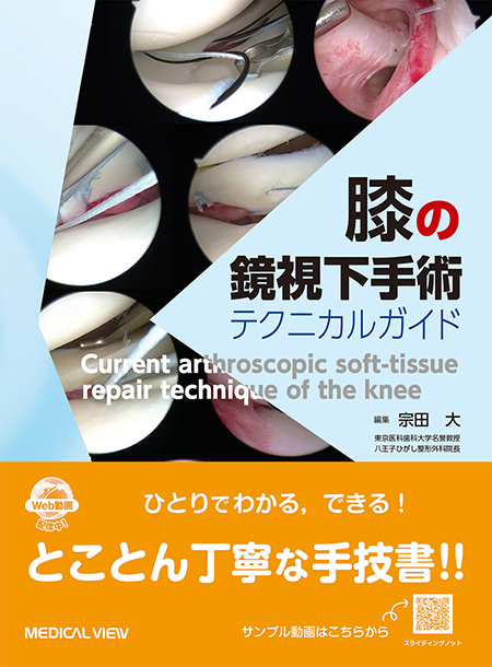 膝の鏡視下手術 テクニカルガイド