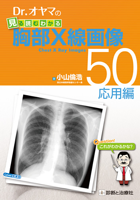 Dr.オヤマの見る読むわかる胸部X線画像50－応用編－