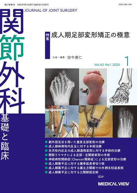 関節外科 2023年1月号 Vol.42 No.1  成人期足部変形矯正の極意