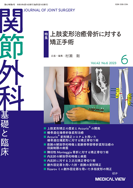 関節外科 2023年6月号 Vol.42 No.6  上肢変形治癒骨折に対する矯正手術