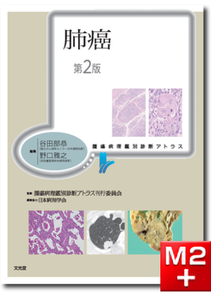 M2PLUS | 非腫瘍性疾患病理アトラス 消化管