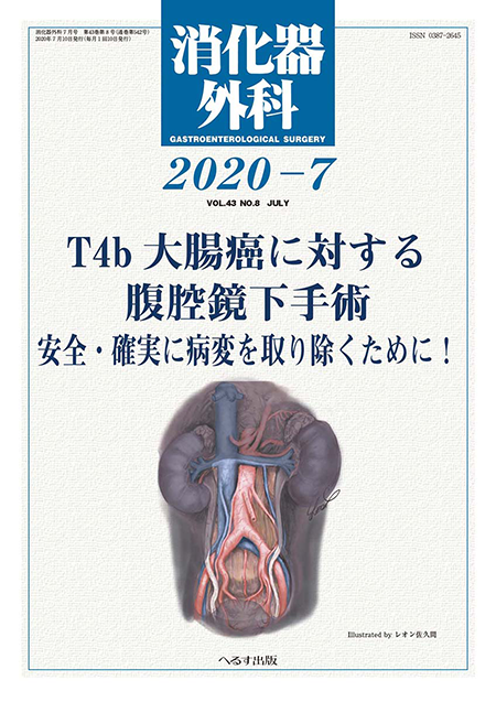 消化器外科 2020年7月号 第43巻第8号 T4b大腸癌に対する腹腔鏡下手術～安全・確実に病変を取り除くために！