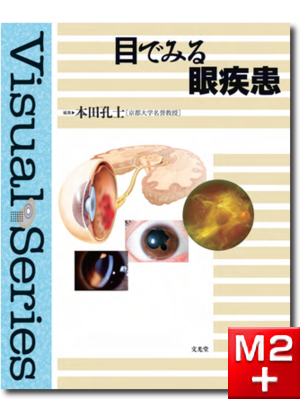 M2PLUS | 視能学 第3版