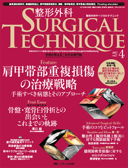 整形外科 SURGICAL TECHNIQUE 2017年4号　特集:肩甲帯部重複損傷の治療戦略