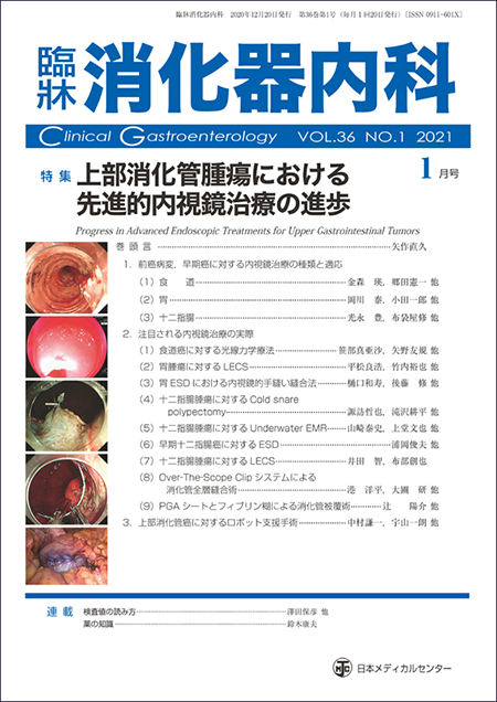 臨牀消化器内科 2021 Vol.36 No.1 上部消化管腫瘍における先進的内視鏡治療の進歩