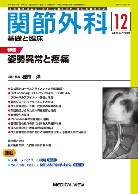 関節外科 2019年12月号 Vol.38 No.12 姿勢異常と疼痛 