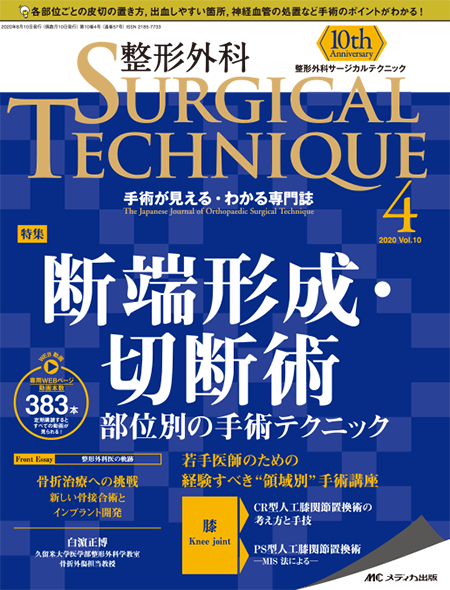 整形外科 SURGICAL TECHNIQUE 2020年4号　特集：断端形成・切断術 部位別の手術テクニック