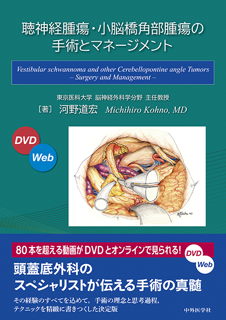 M2PLUS | 新・脳血管内治療兵法書～宮地流 心・技・体 六十八手