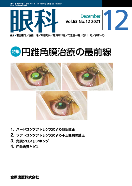 眼科 2021年12月号 63巻12号 特集  円錐角膜治療の最前線 【電子版】