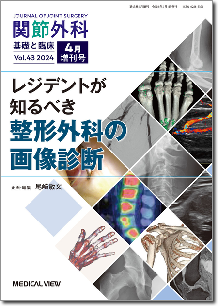 関節外科 2024年4月増刊号 レジデントが知るべき整形外科の画像診断