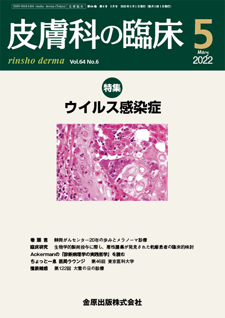 皮膚科の臨床 2022年5月号 64巻6号 特集 ウイルス感染症 【電子版】