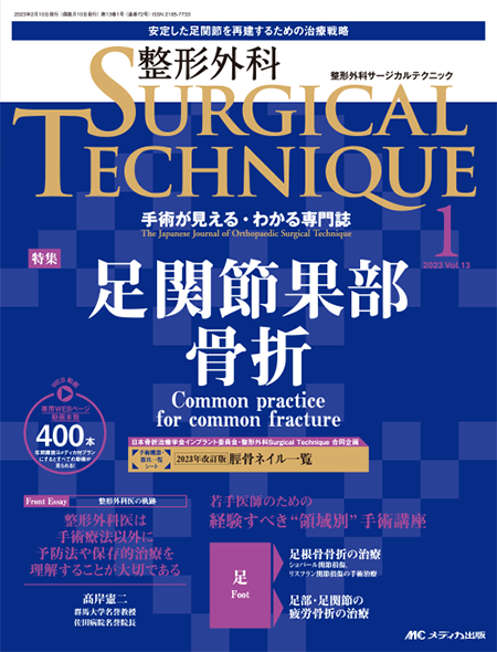 整形外科 SURGICAL TECHNIQUE 2023年1号　　特集:足関節果部骨折
