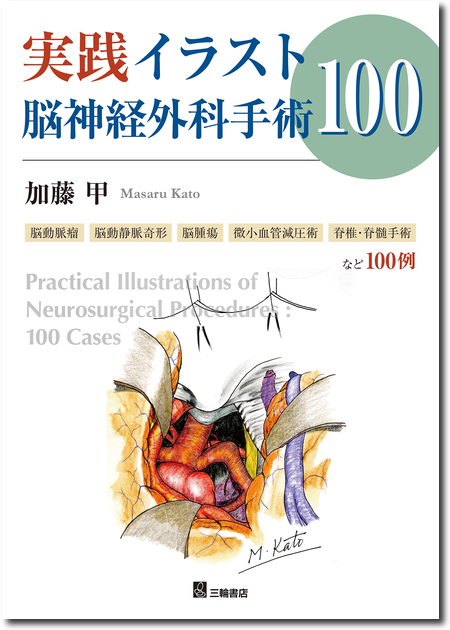 実践イラスト脳神経外科手術100