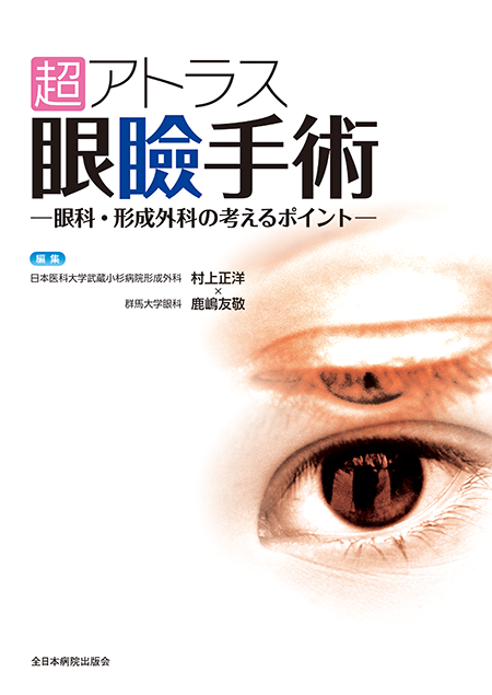 超アトラス眼瞼手術―眼科・形成外科の考えるポイント―