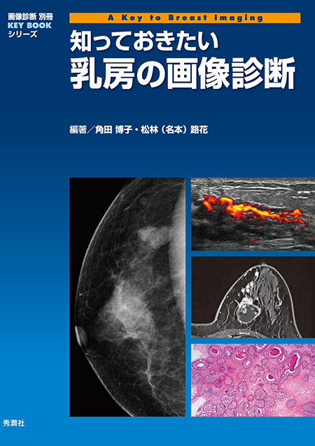画像診断別冊 KEY BOOKシリーズ  知っておきたい乳房の画像診断