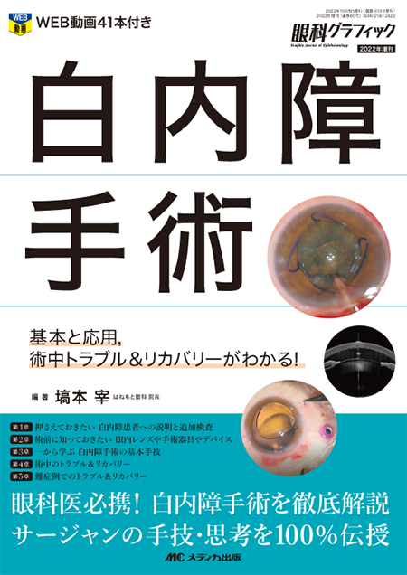 眼科グラフィック2022年増刊 白内障手術
